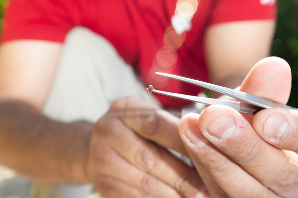 a close-up impage of a hands and tweezers holding a tick